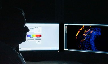 Estudo busca identificar tratamento gênico para Síndrome de Pitt-Hopki