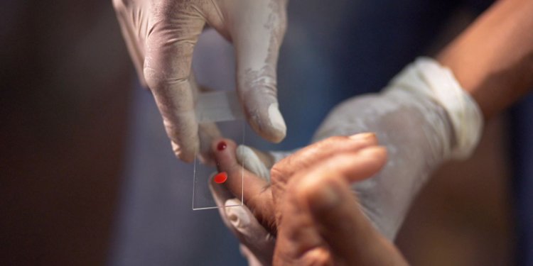 Ministério da Saúde quer zerar casos de malária no país até 2035