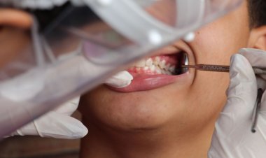 Ministério da Saúde inicia Pesquisa Nacional de Saúde Bucal