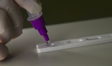 Boletim aponta aumento de casos de covid-19 no estado do Rio