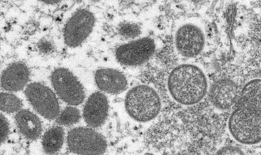 Macaé investiga suspeita de varíola dos macacos