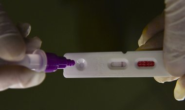 Pesquisadores identificam método capaz de prever gravidade da covid-19