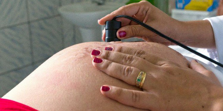 Brasil: pesquisa faz mapeamento da incidência de malária em gestantes