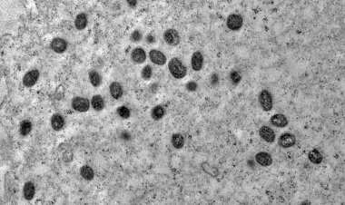 Minas Gerais tem segunda morte por varíola dos macacos confirmada