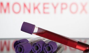 SP registra primeira morte por varíola dos macacos