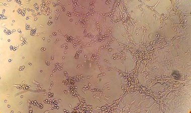 SP: Praia Grande confirma morte de homem por varíola dos macacos