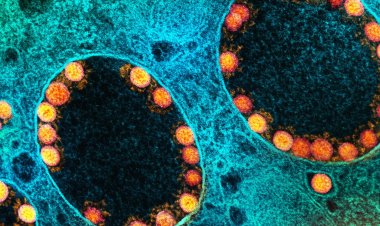 Fiocruz confirma subvariante Ômicron BQ.1 na cidade do Rio de Janeiro