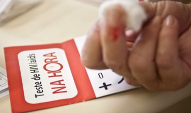 Desigualdades e estigmas prolongam pandemia de Aids